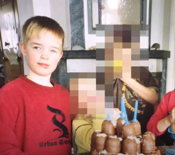 Fix Lazy Eye In Pictures