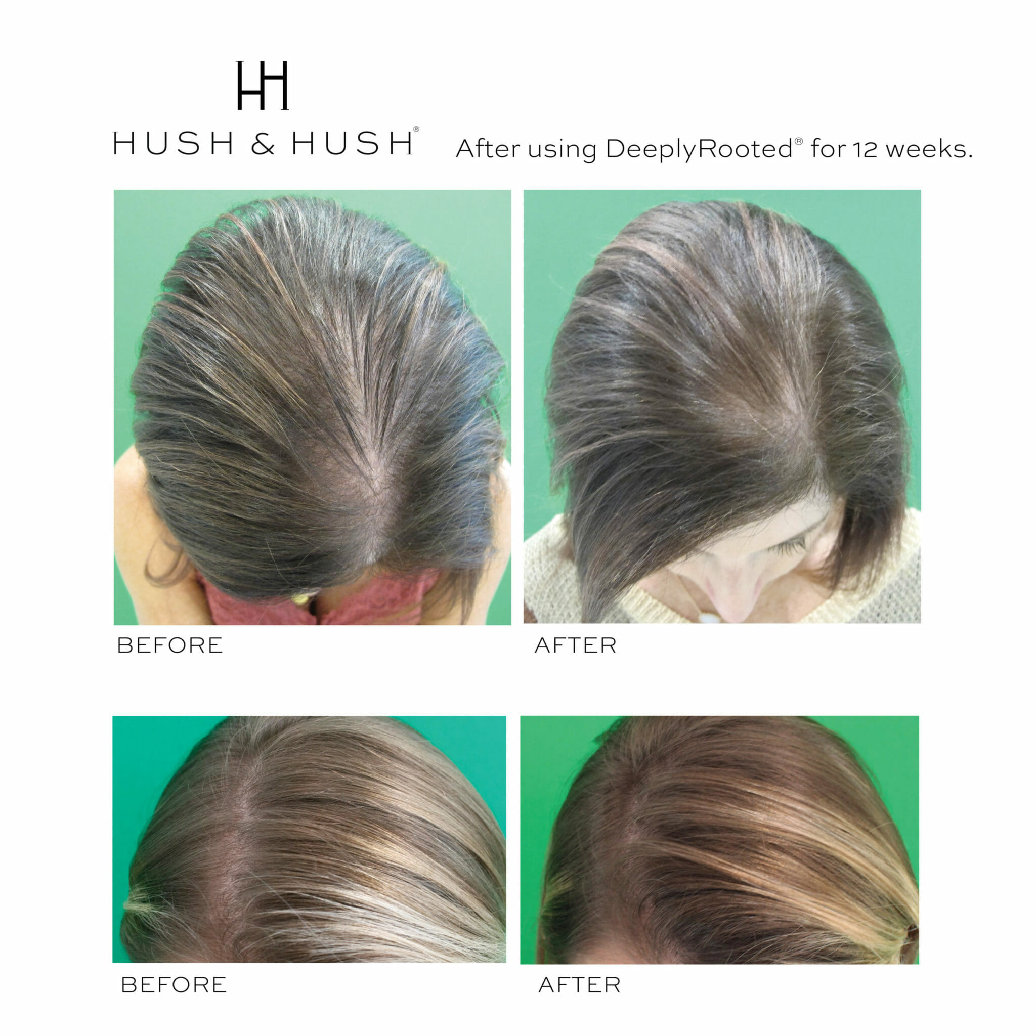 Viên Uống Chống Rụng Tóc Deeply Rooted
