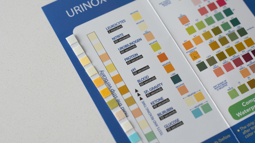 Urine Dipstick Color Chart Vrogue co