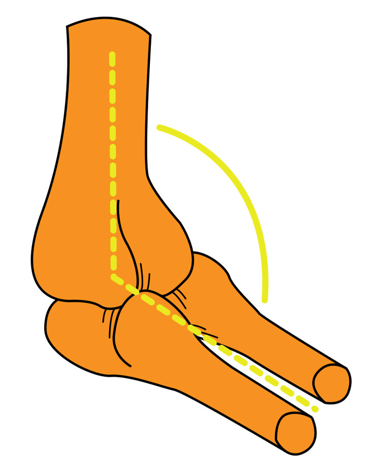 Elbow Joint w Angle for Blog.jpg