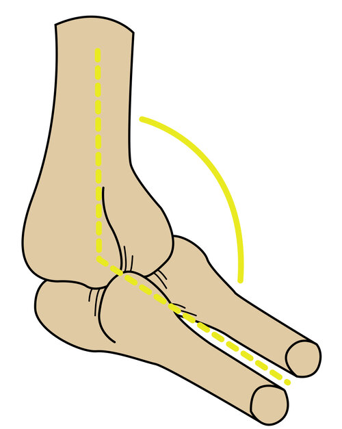 Joint Range of Motion (ROM)
