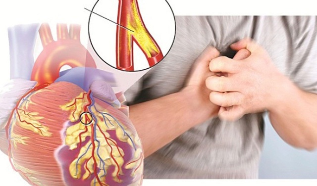 Coi thường mỡ nhiễm máu - Những biến chứng nguy hiểm không ngờ - 1