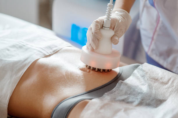 Radiofrequency treatment is another body sculpting & fat reduction treatment
