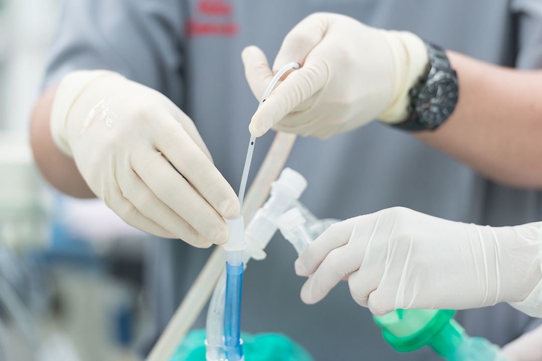 Intubation vs. Extubation Process Explained