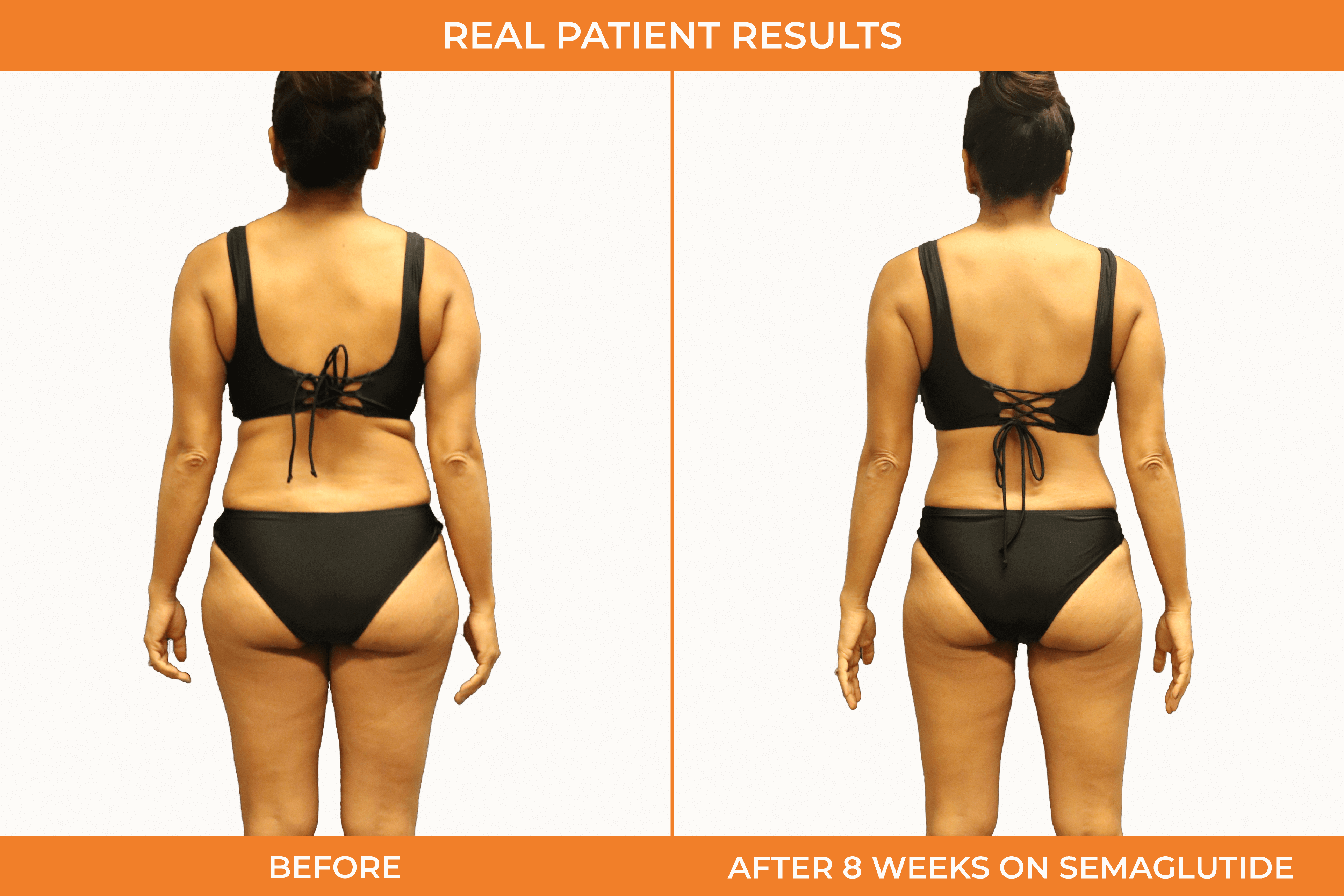 Moto Weight Loss Reviews - czv9hmi