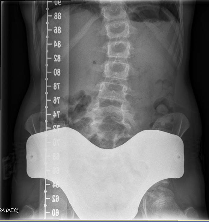Ovarian XRay Shield Frankie Lyon Design