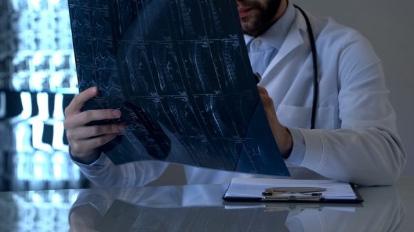 Facts And Figures About Spinal Cord Injuries