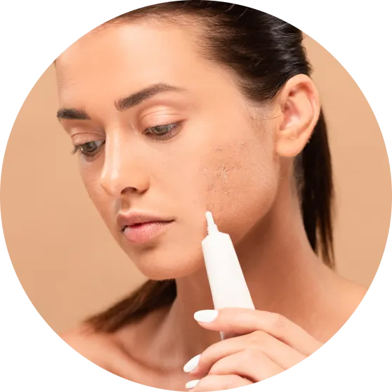 Diode Laser IPL Treatments — Beauty Lab Westmount