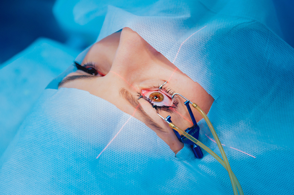 Laser Iridotomy & The Risks West Boca Eye Center