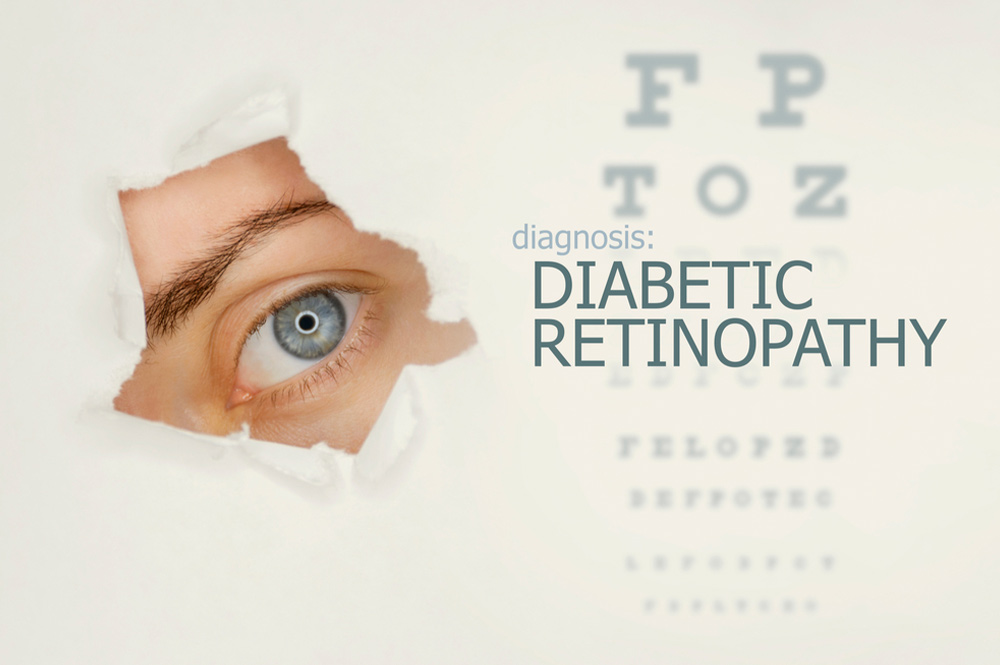 3 Ways Diabetes Can Affect Your Eyes West Boca Eye Center