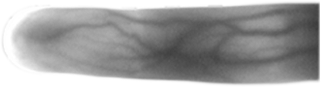 How does vein pattern recognition work?
