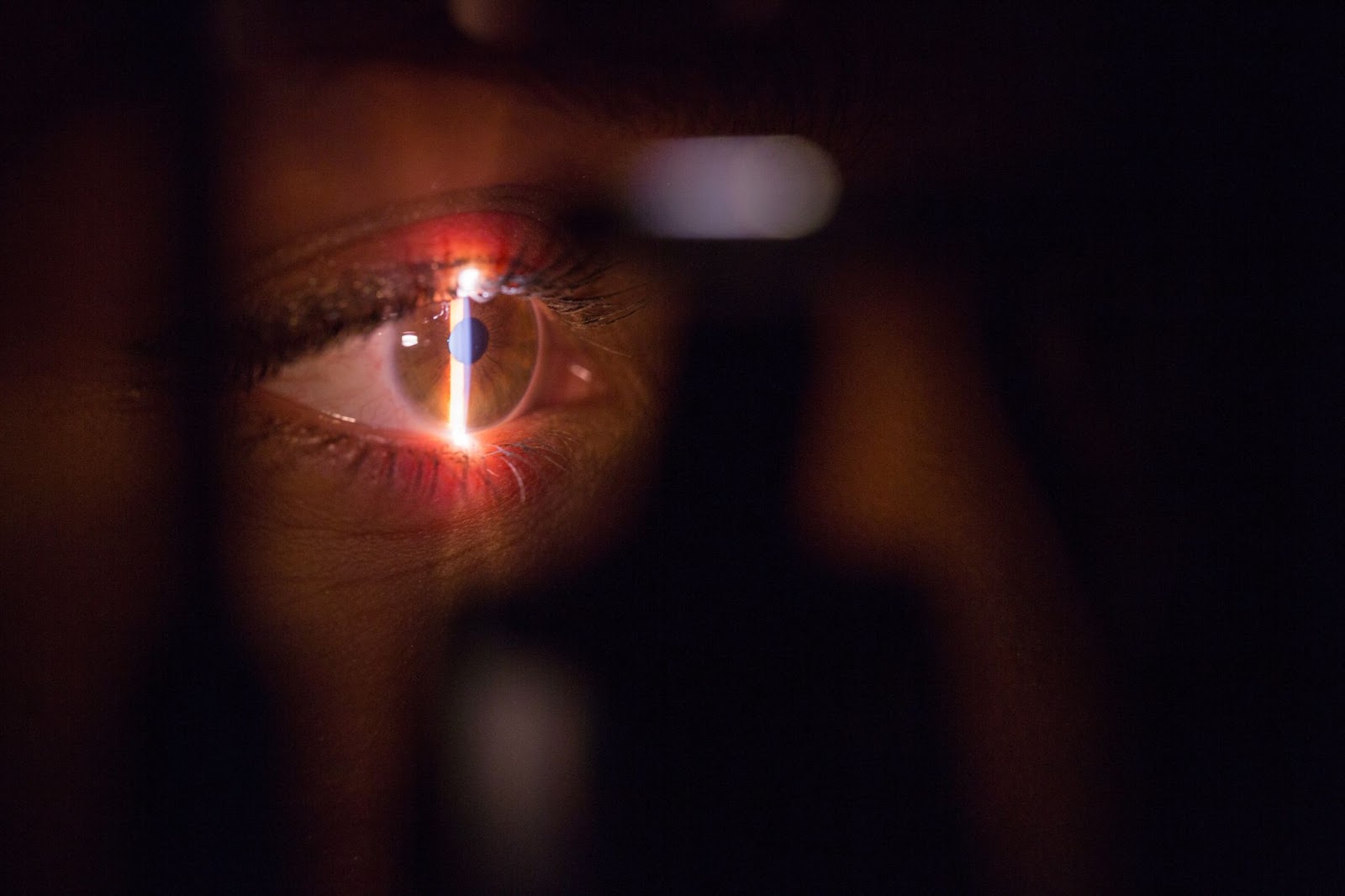 Retinal recognition process