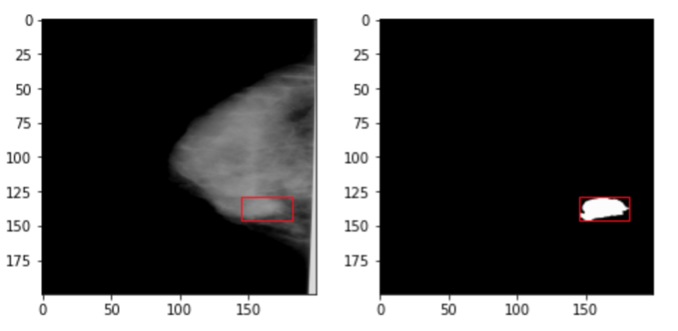 Detection