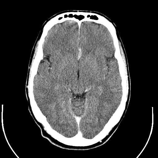 DICOM file image