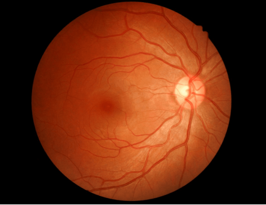 The Retina
