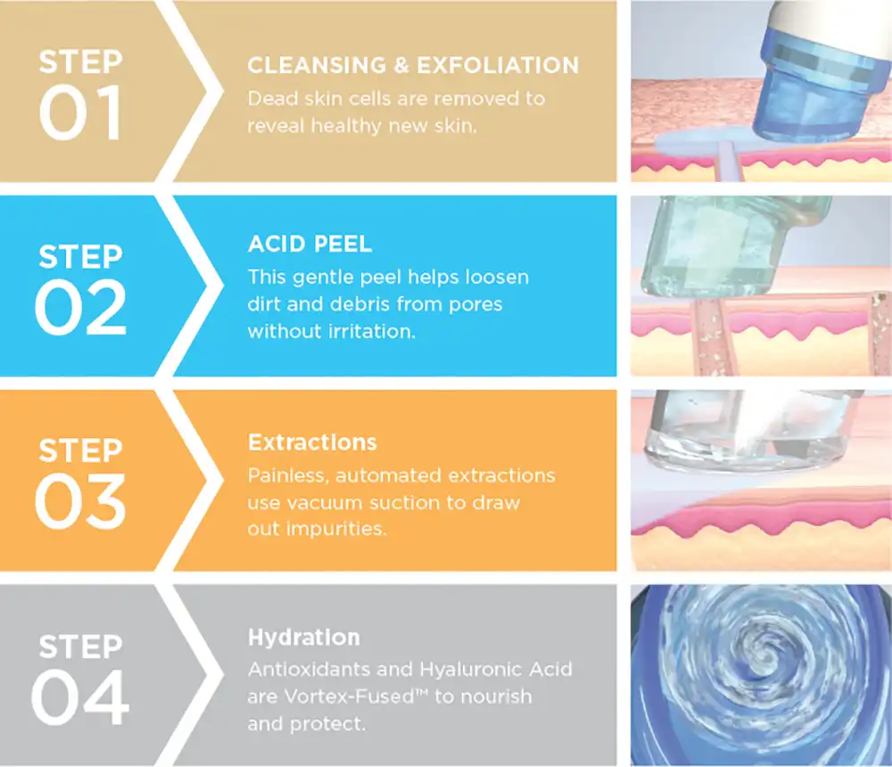 Hydrafacial 4 step process