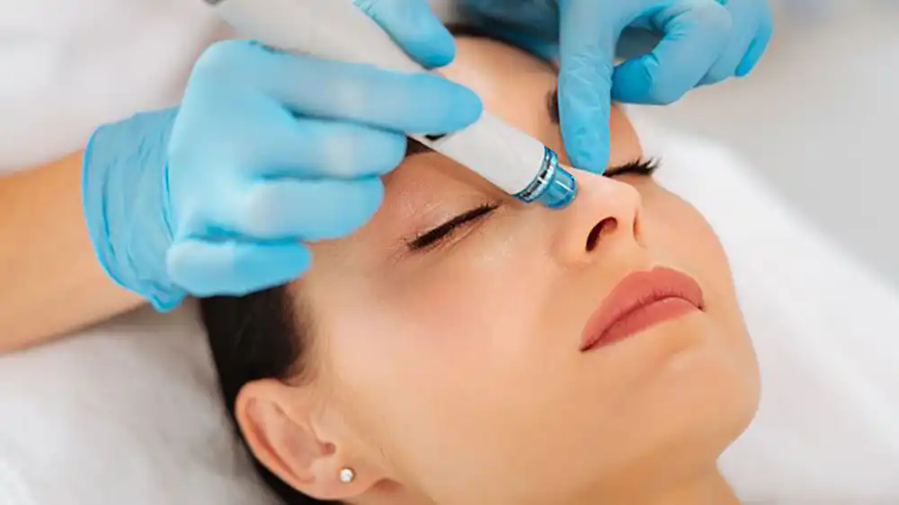 Hydrafacial treatment