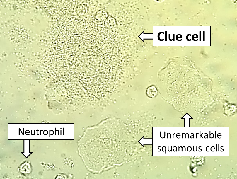 What Is A Wet Mount Microscope At Kayla Clubbe Blog