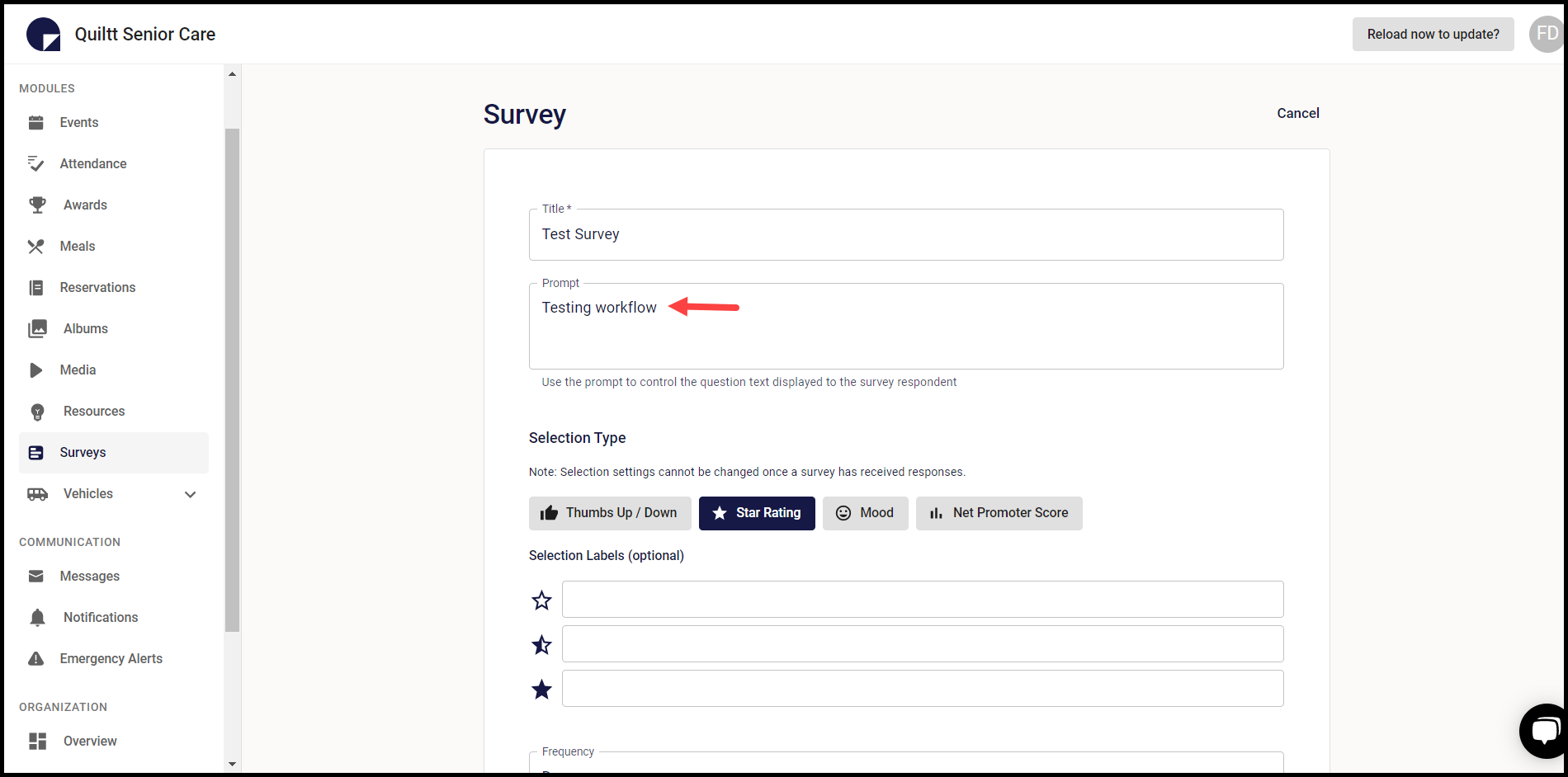 How to Add a Survey?