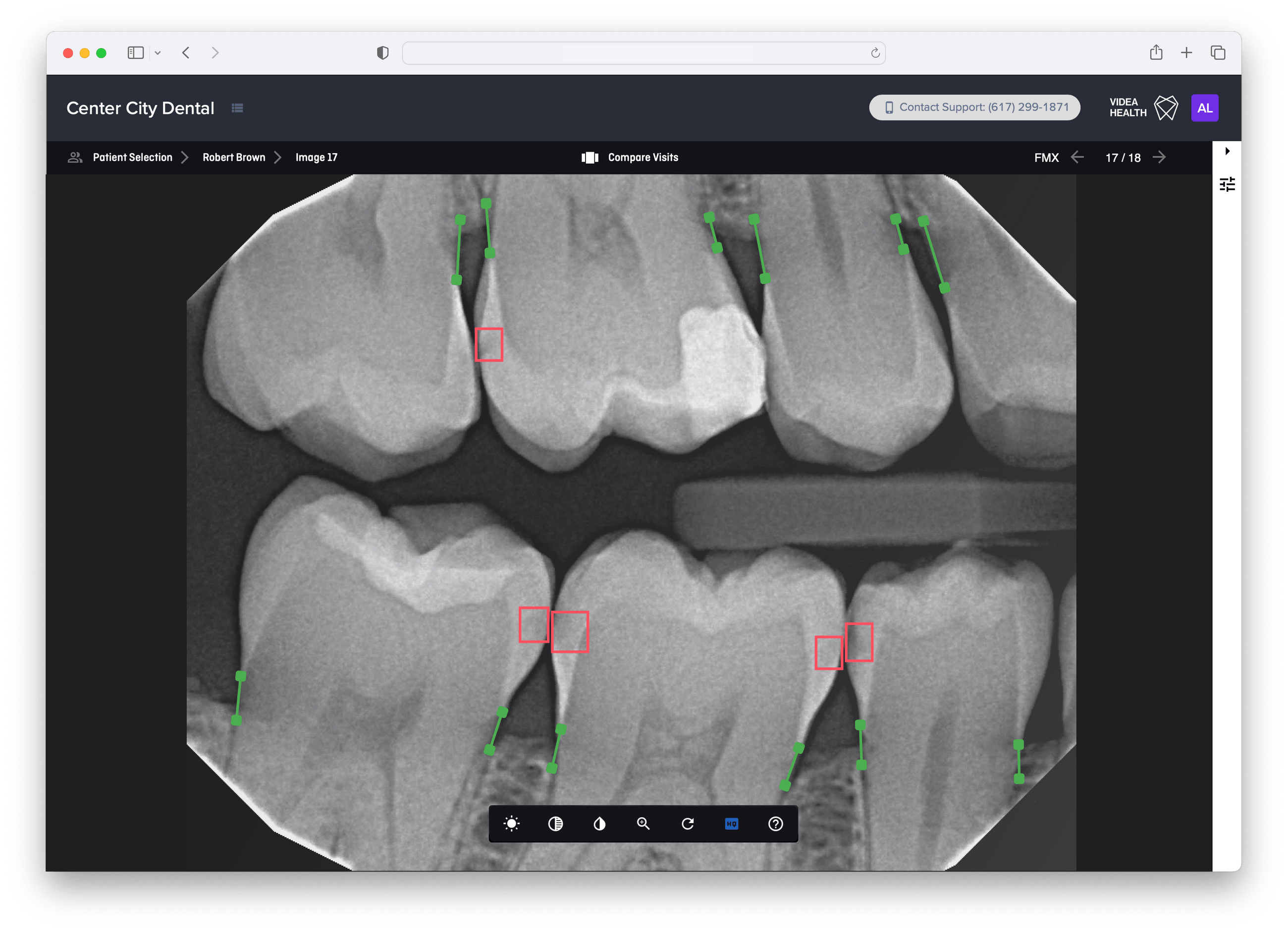 Live3 Dentrix Ascend - d068par