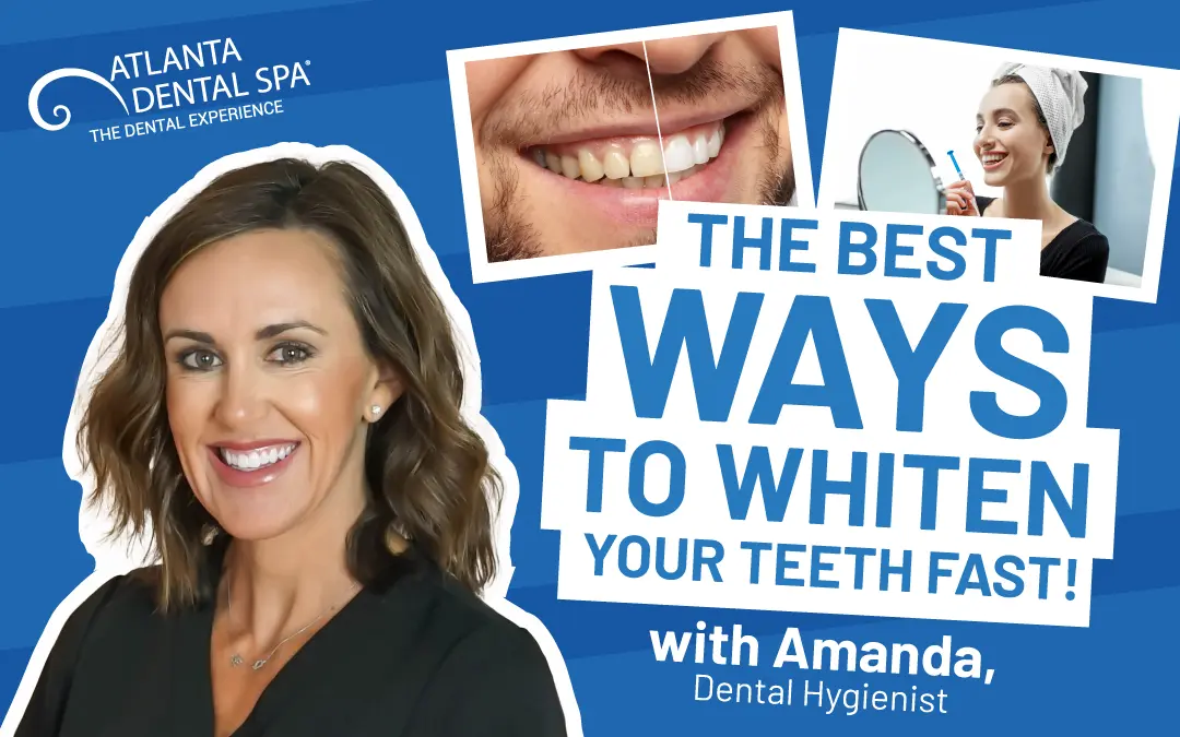 Vlog Atlanta Dental Spa