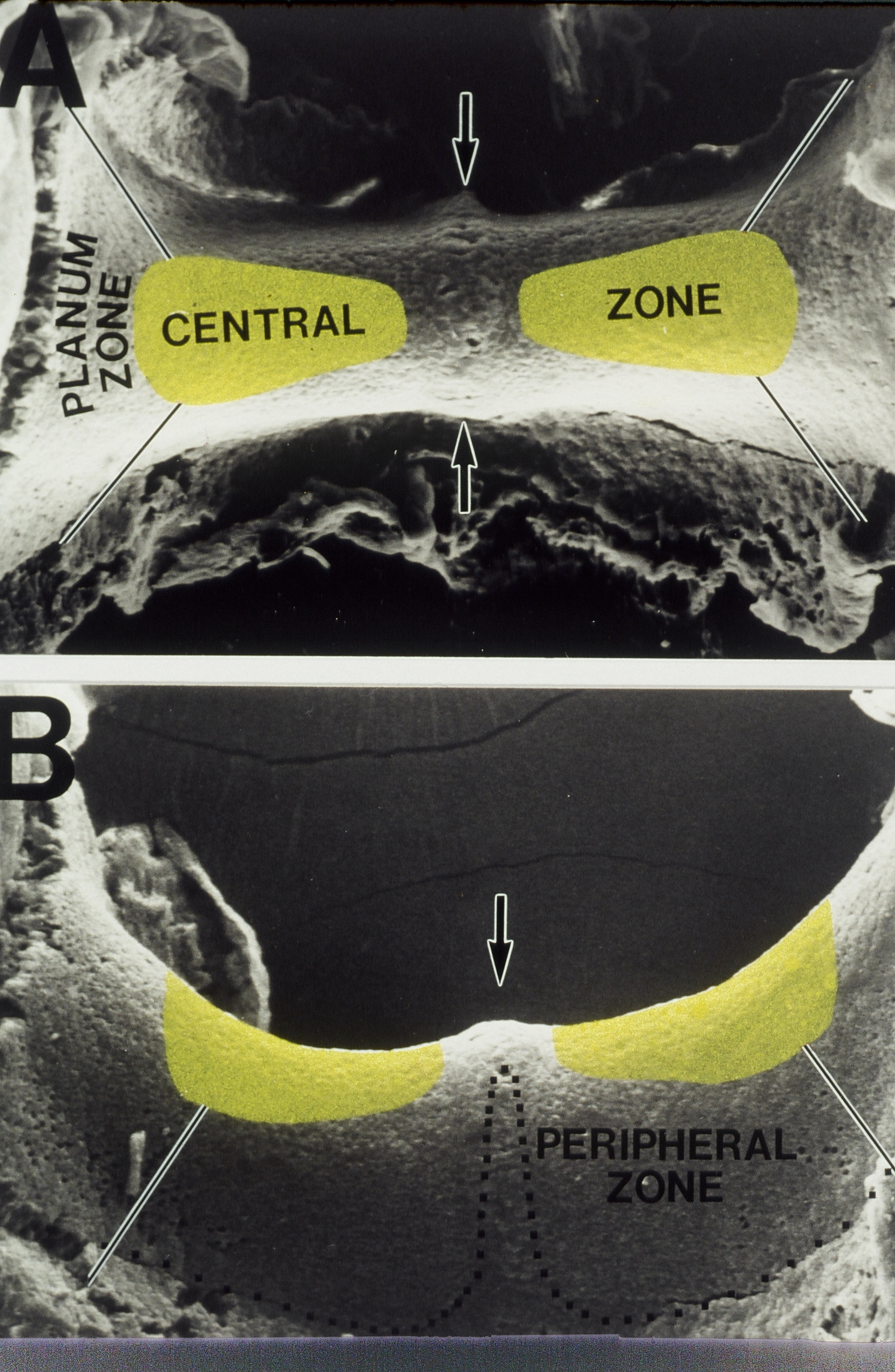 The Inner Ear
