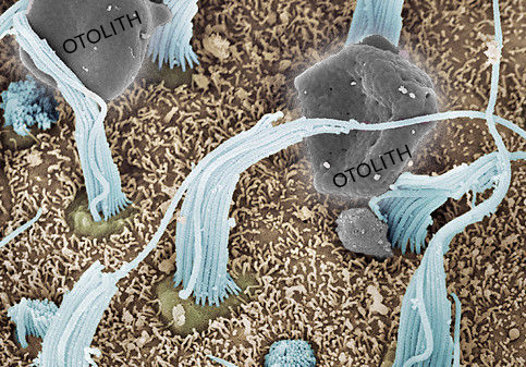 The Inner Ear