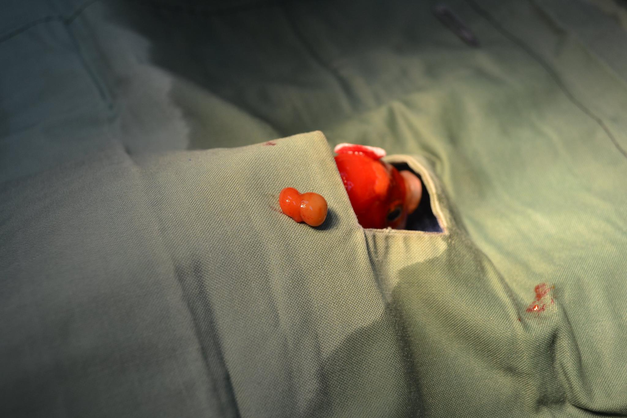 poisson-rouge-operation-19