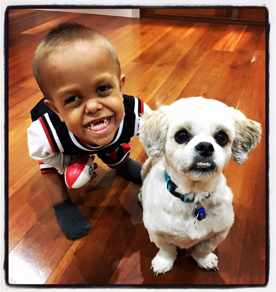 quaden-dwarf-buddy-8