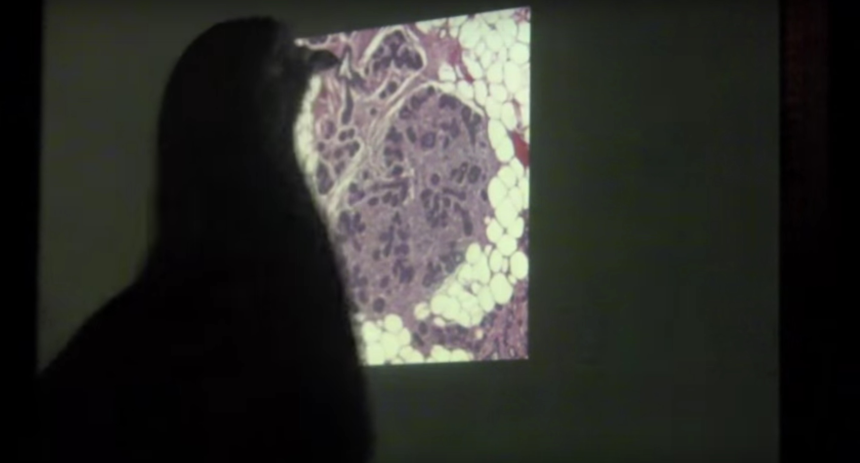 pigeon-cancer-detection-4