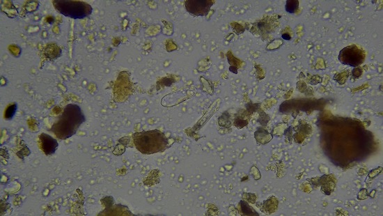 NO-DIG - Diatom with Testate Amoeba to its upper left - note humic-fulvic aggregates