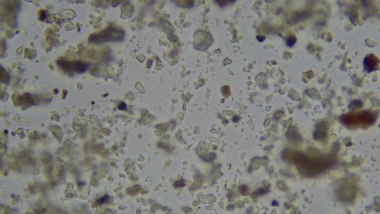 DIG BED - Few macro-aggregates or microbial volume or diversity