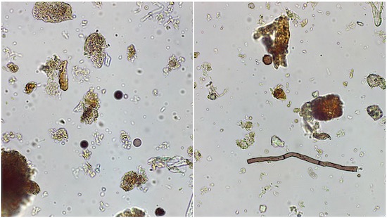 Microscope views of the compost like material from the bioreactor on the left, and from the pile of same wood chips one year old which had been in a heap on the ground nearby