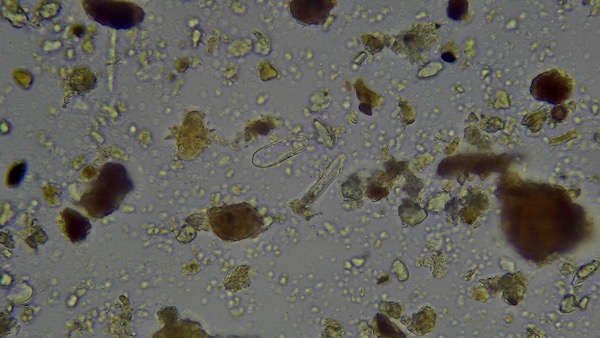 No dig bed October 2021 found a diatom with testate amoeba to its upper left - note humic-fulvic aggregates, x 400 by Eddie Bailey