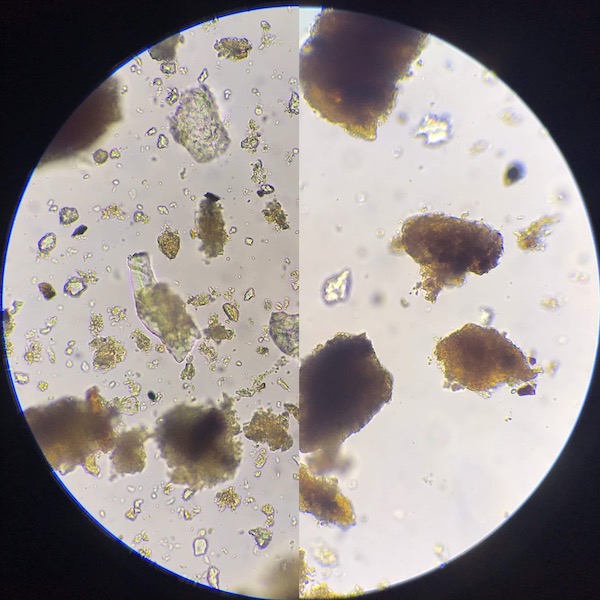 x 400 microscope analysis of dig left no dig right with aggregation of no dig making better resistance to erosion, less unbound material, by Kate Solbakk of Norway September 2019