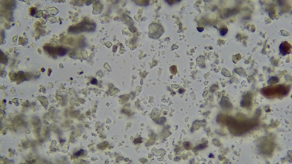 Dig bed October 2021, shows few macro-aggregates or microbial volume or diversity