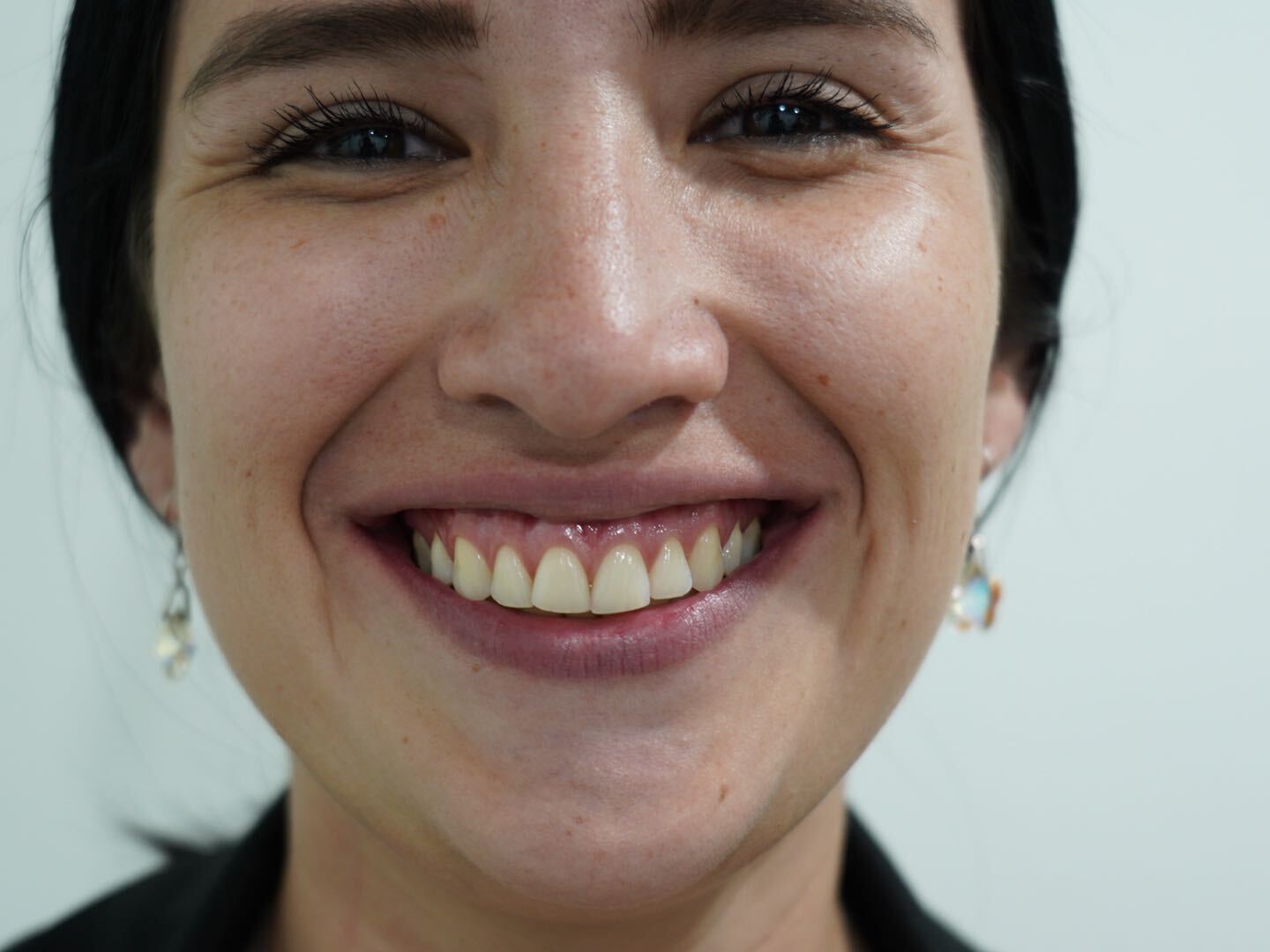 Free Quotation Montero Smile Art Dental Clinic