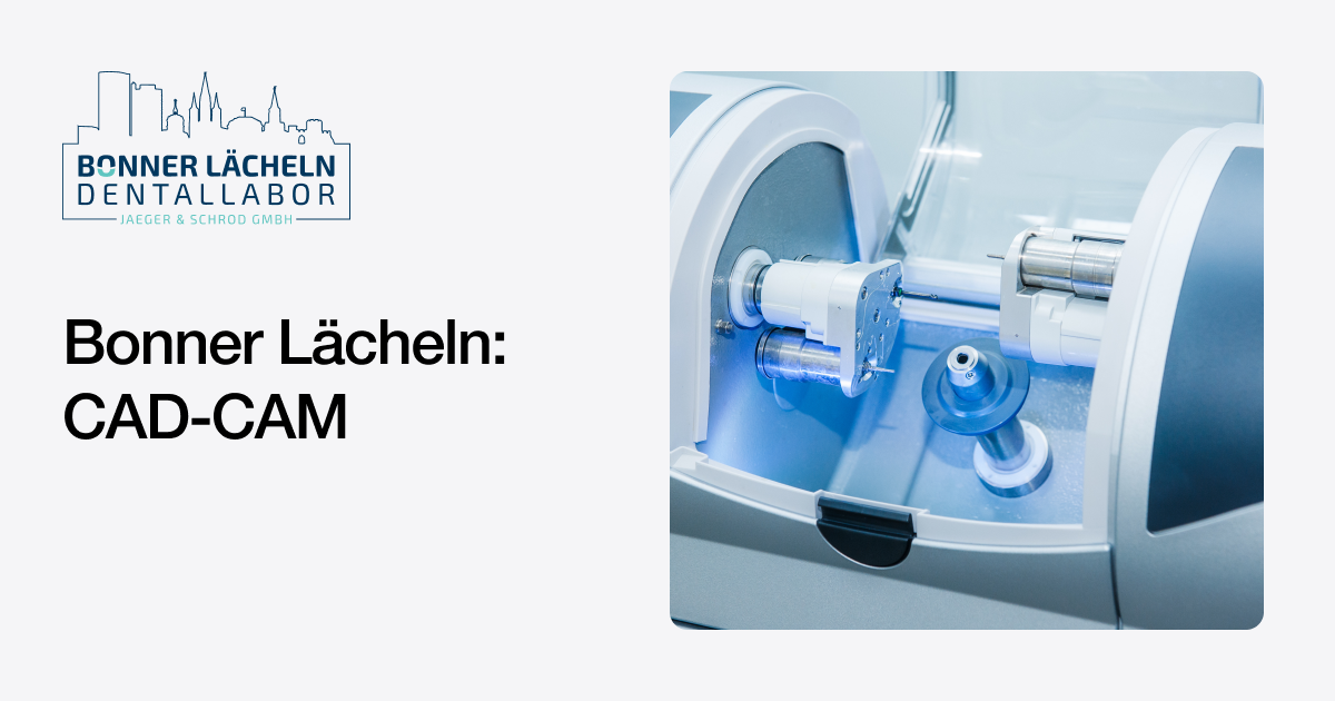 CAD-CAM | Leistungen | Bonner Lächeln