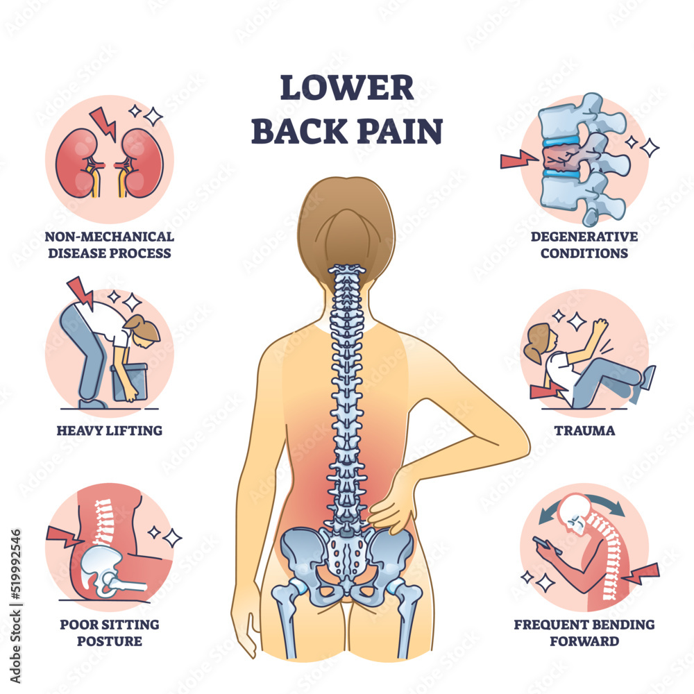 Causes of back pain illustration