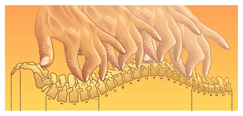 Chiropractic spinal manipulation illustration