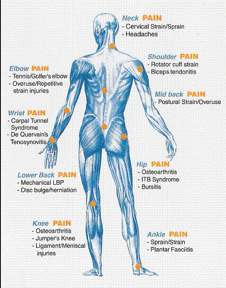 Common conditions treated by chiropractors