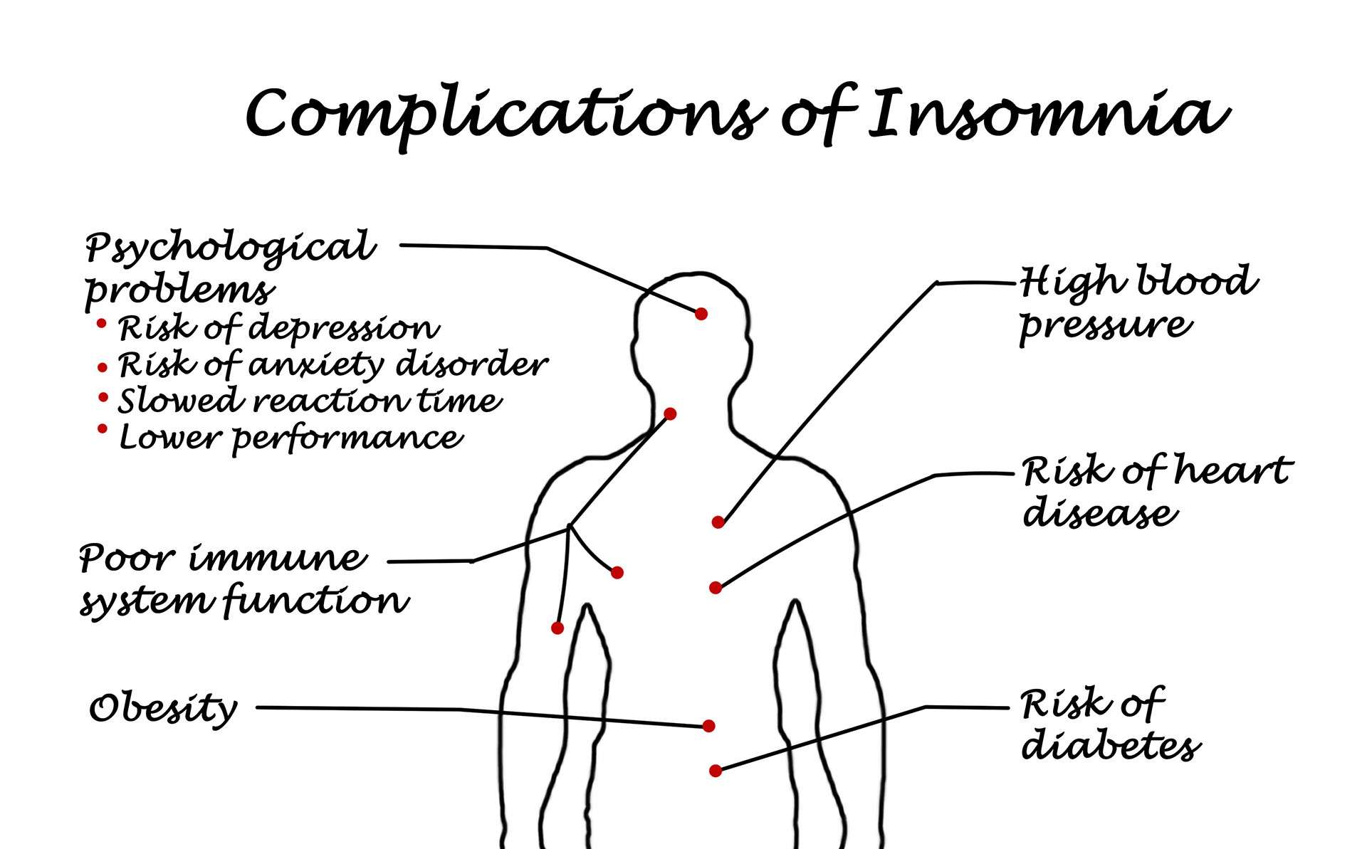 Disrupted sleep due to back pain image