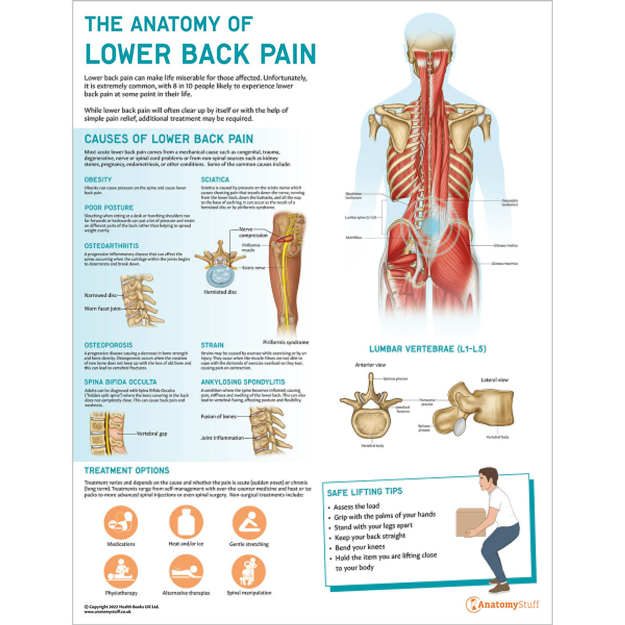Causes of back pain diagram