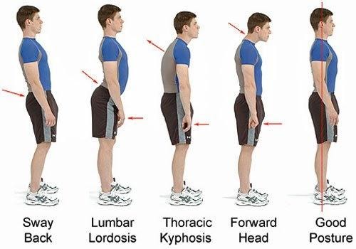 Chiropractic treatment for good posture