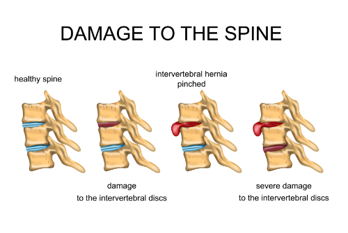 chiropractic for spinal health