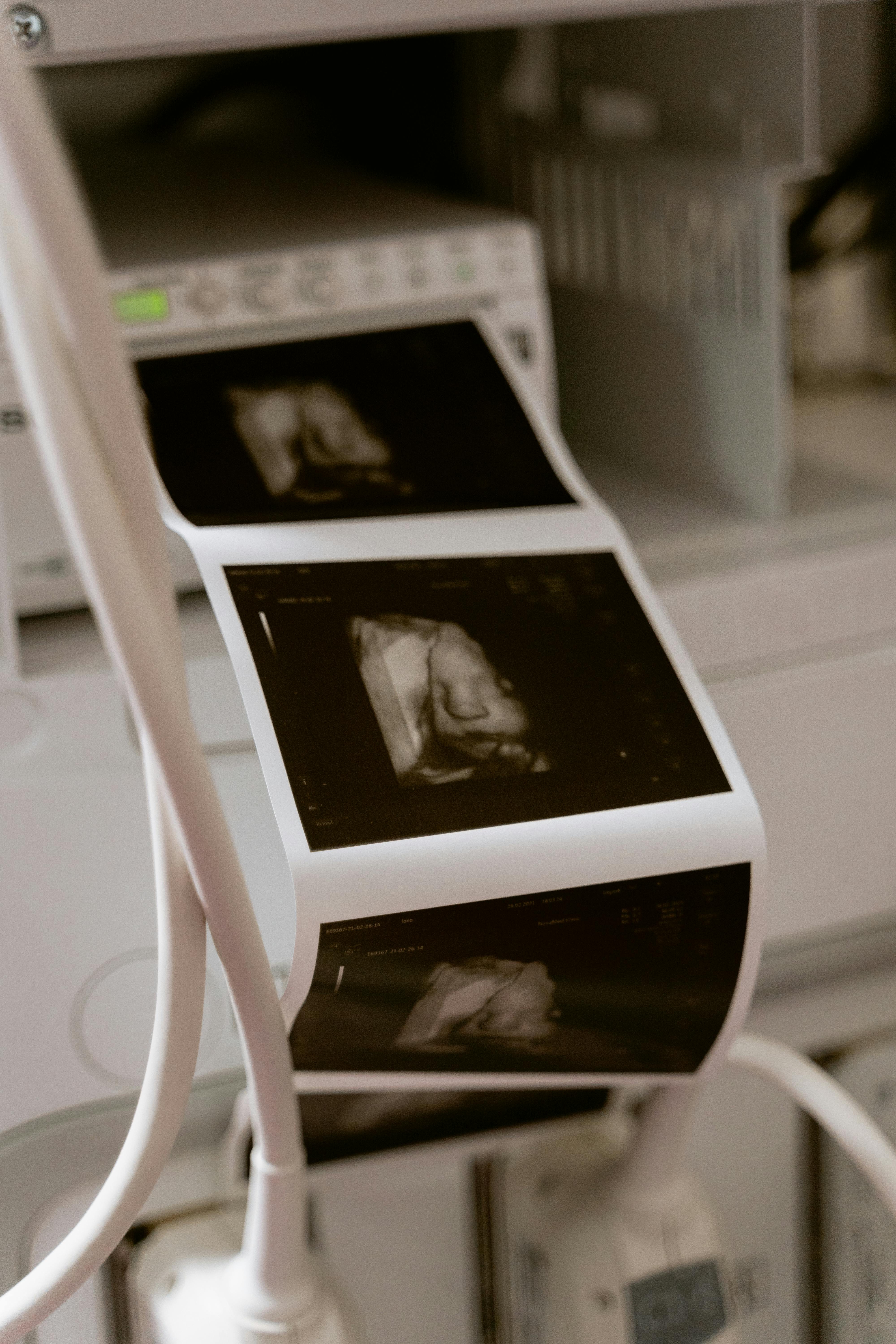 MedSAM-2 von Oxford: Neue Ära der medizinischen Bildanalyse durch Künstliche Intelligenz