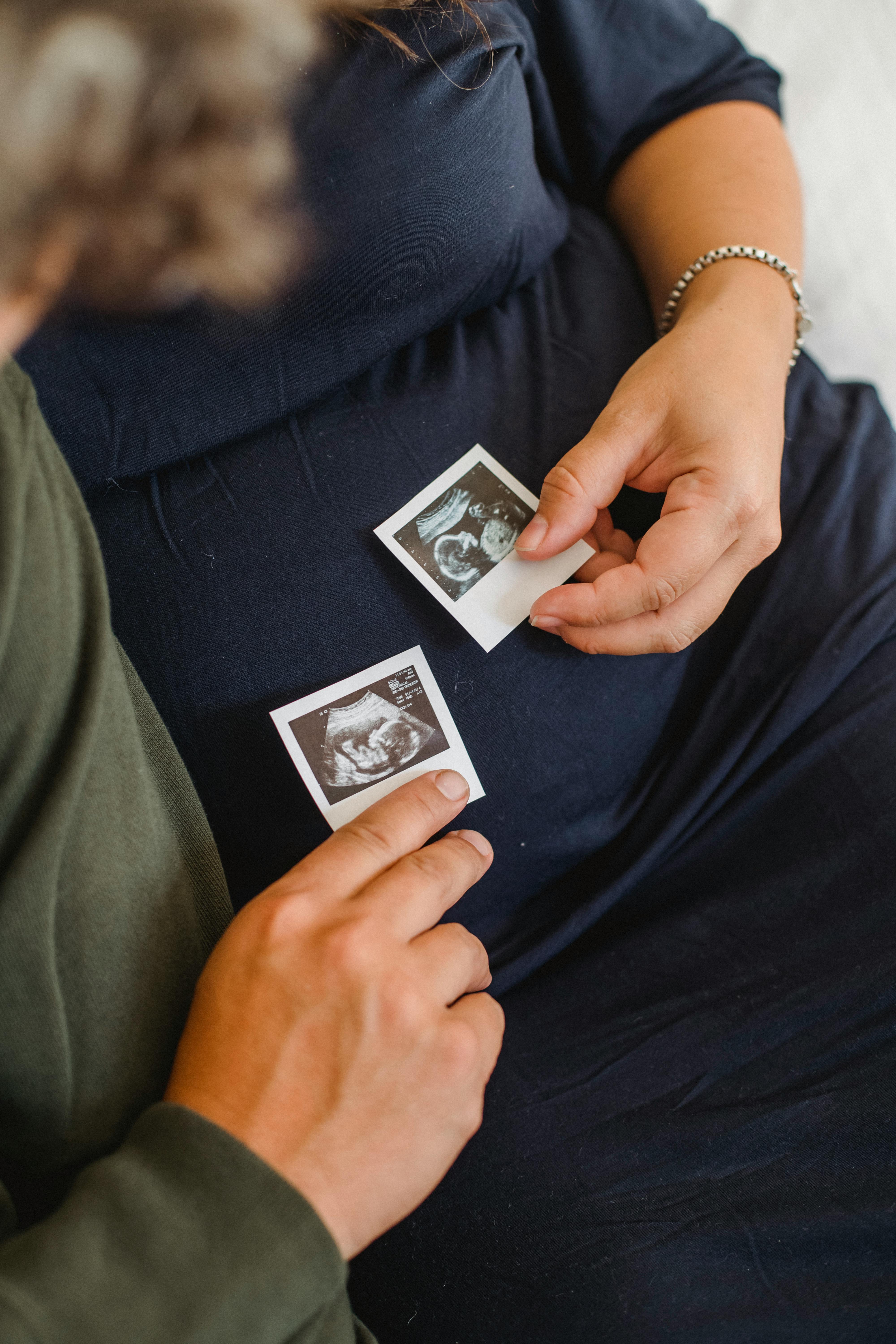 MedSAM-2: Ein neues Zeitalter in der medizinischen Bildsegmentierung durch KI