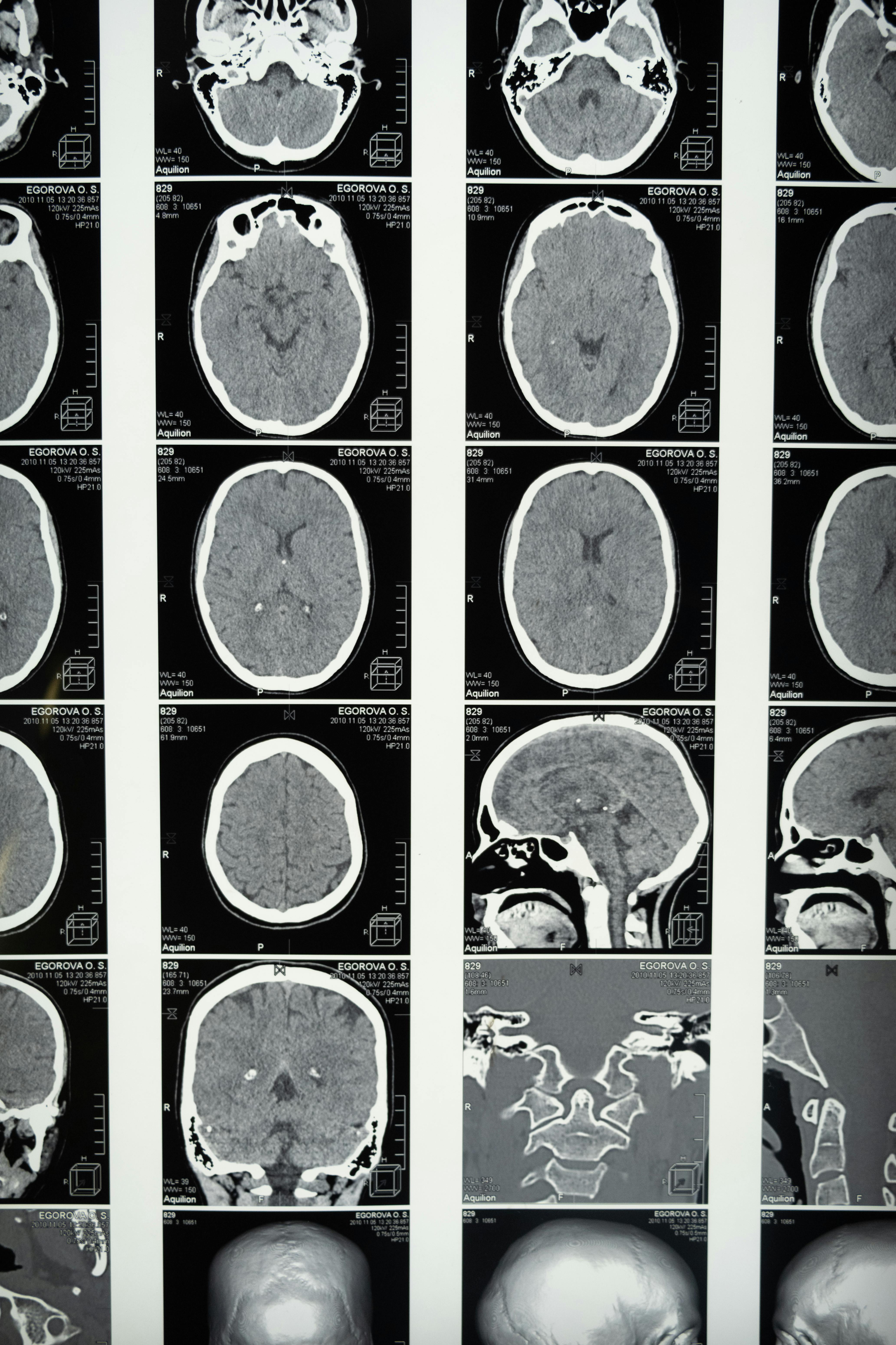MedTrinity-25M Neuartiger Meilenstein in der medizinischen Bildgebung und Datenanalyse