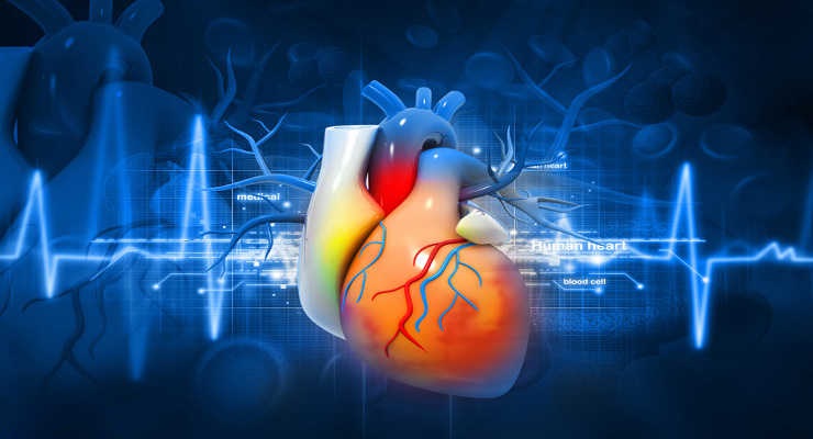 cardiac disease